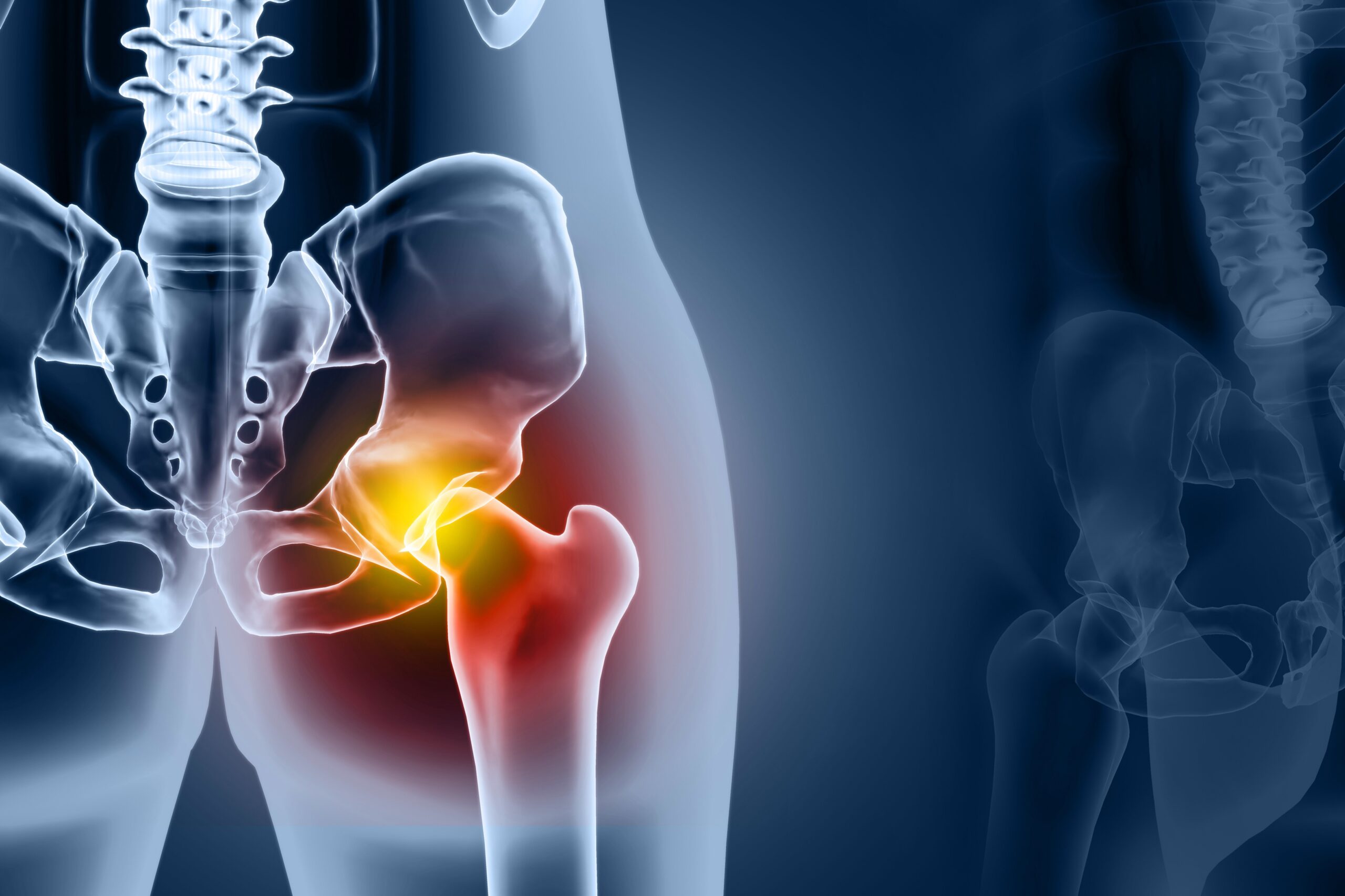 股関節痛の原因イメージ画像